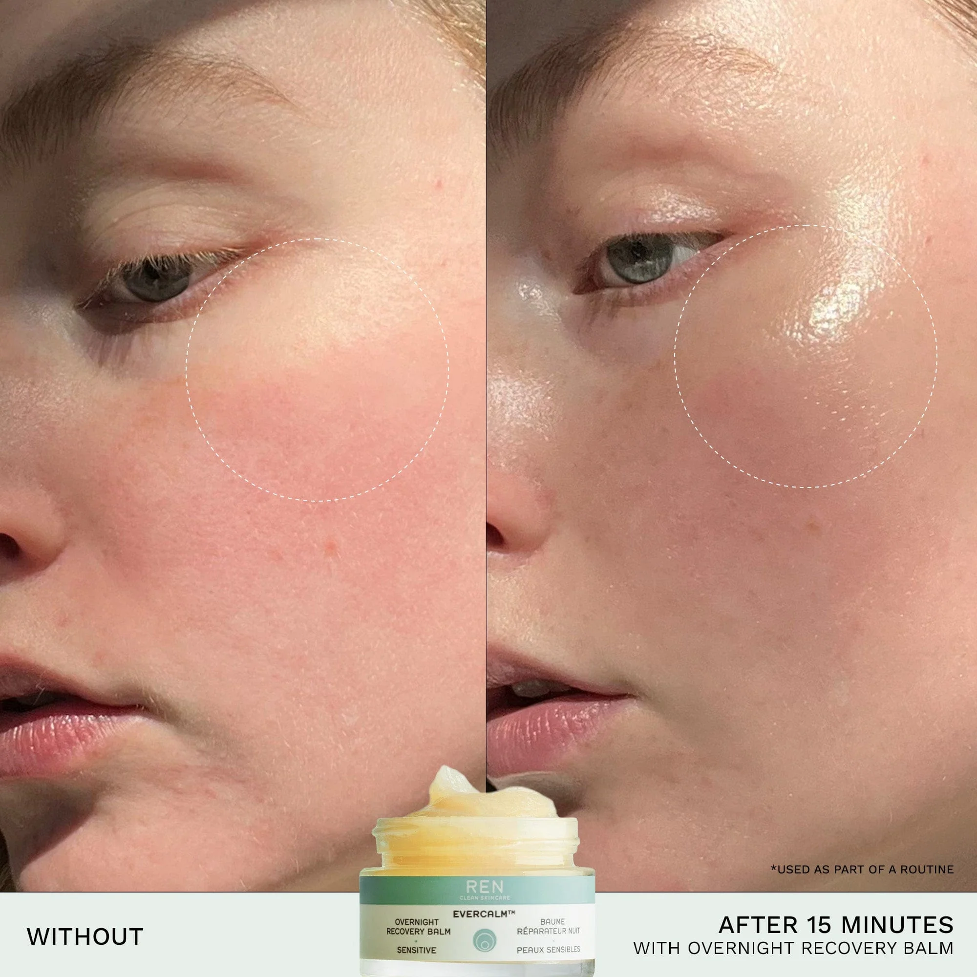 Evercalm™ Overnight Recovery Balm